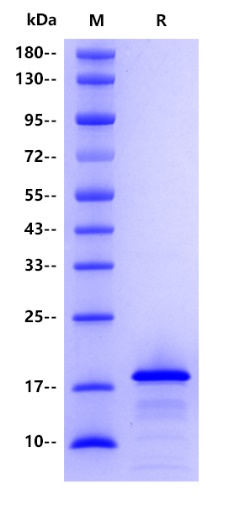 Human TPX2, His tag