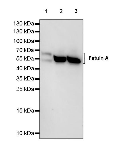 Fetuin A Recombinant Rabbit mAb (S-1109-5)