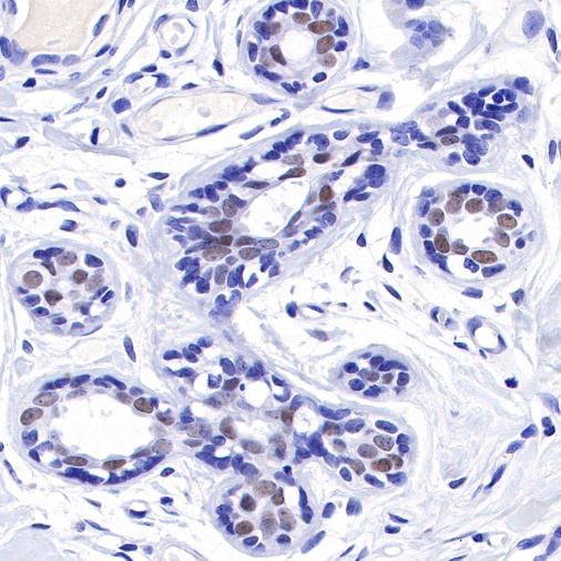 TRPS1 Recombinant Rabbit mAb (S-765-3)