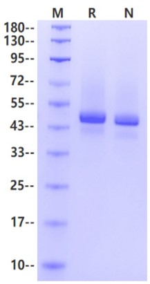 Carbonic Anhydrase IX/CA9 His Tag Protein, Mouse