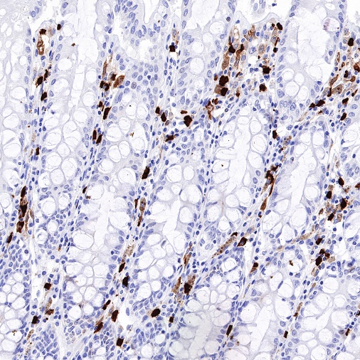 ALOX15 Recombinant Rabbit mAb (S-669-56)