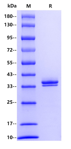 Human CCL17 Protein, hFc tag