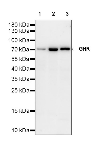 GHR Recombinant Rabbit mAb (S-1320-123)