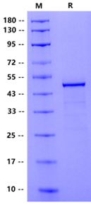 VHL GST Tag Protein, Human