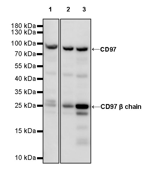 CD97 Recombinant Rabbit mAb (S-667-80)
