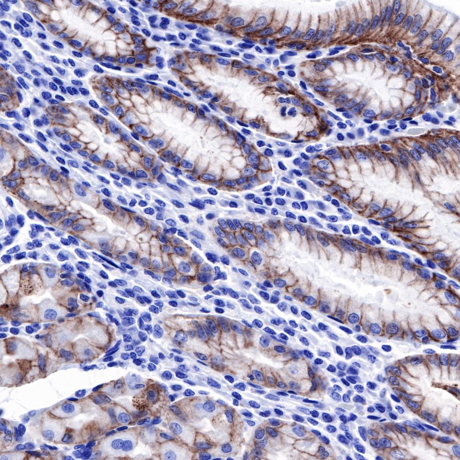 Claudin18.2 Recombinant Rabbit mAb (SDT-102-24)