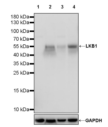 LKB1 Recombinant Rabbit mAb (S-1264-31)