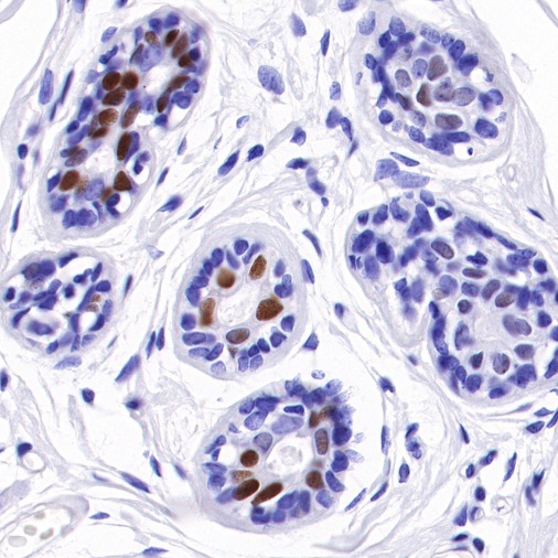 Estrogen Receptor α Recombinant Rabbit mAb (SDT-10001)