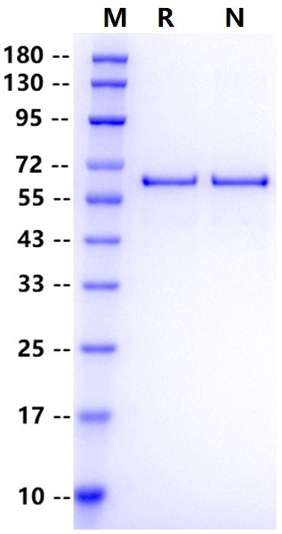 H1N1 NP (A/Puerto Rico/8/1934) His Tag Protein, Influenza