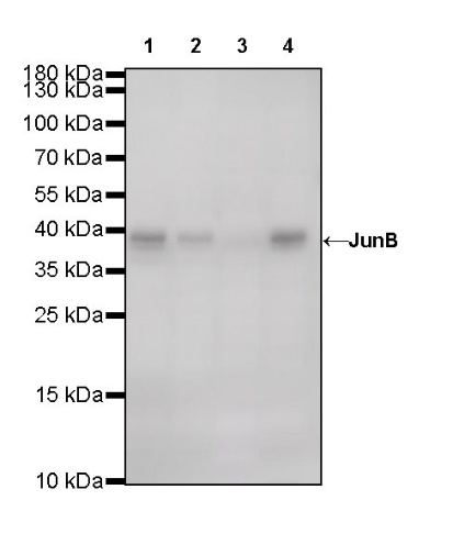 JunB Recombinant Rabbit mAb (S-R294)