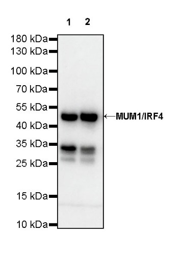 MUM1/IRF4 Recombinant Rabbit mAb (S-654-33)