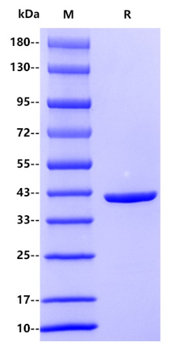 E. coli MBP Protein, His tag