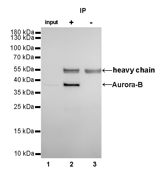 Aurora-B Recombinant Rabbit mAb (SDT-079-32)