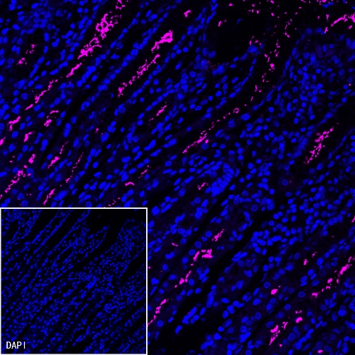 Helicobacter pylori Recombinant Rabbit mAb (Cy5 Conjugate) (S-R273)