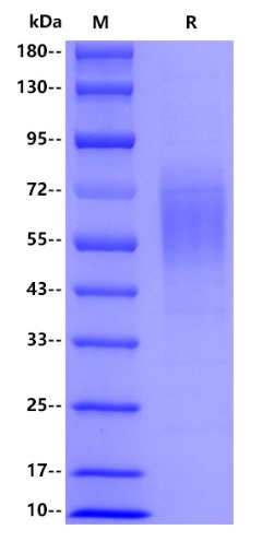 Human BRCA2, His tag