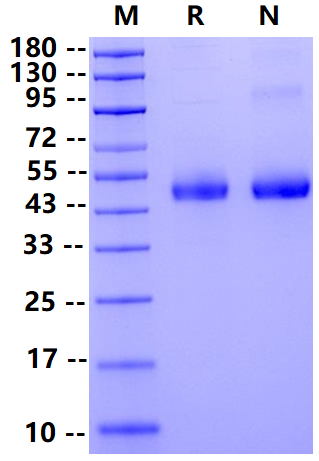 Biotinylated ACPP/PAP His&Avi Tag Protein, Human