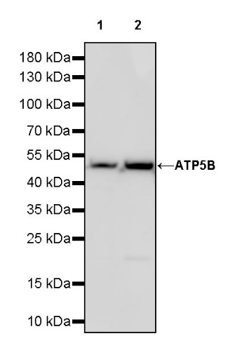 ATP5B Recombinant Rabbit mAb (S-1271-29)