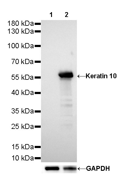 Keratin 10 Recombinant Rabbit mAb (SDT-124-6)