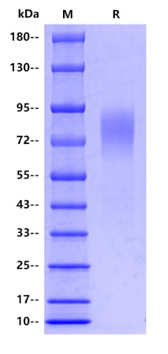 Human SCARB1/SR-BI Protein, His tag