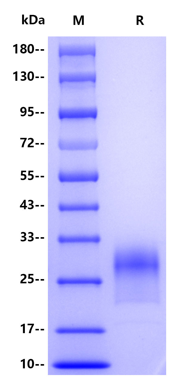 Human IL-19, His tag