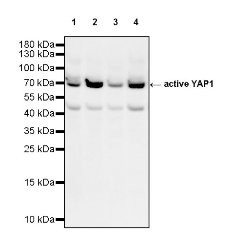 active YAP1 Recombinant Rabbit mAb (S-516-142)