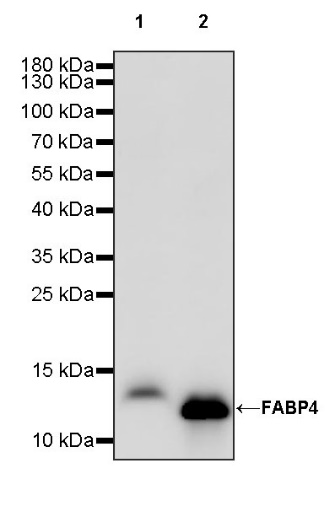 FABP4 Recombinant Rabbit mAb (S-1360-58）