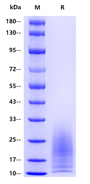 Human NF-H（Neurofilament heavy polypeptide） , His tag