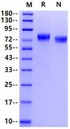 EphA5 His Tag Protein, Human