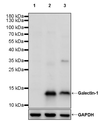 Galectin-1/LGALS1 Rabbit Polyclonal Antibody
