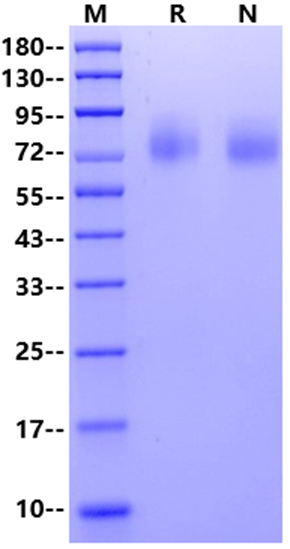 TrkA/NTRK1 His Tag Protein, Human