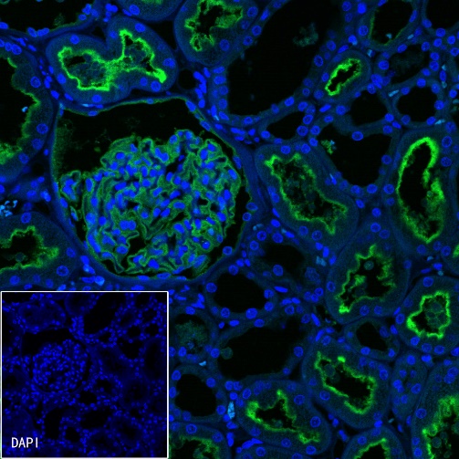 CD10 Recombinant Rabbit mAb (Alexa Fluor® 488 Conjugate) (S-006-77)