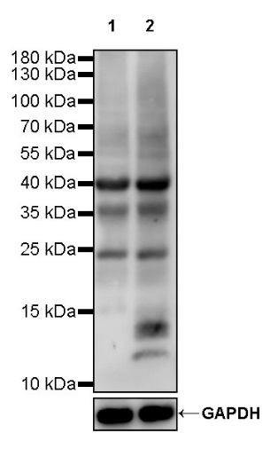 Acetyllysine Rabbit polyclonal antibody
