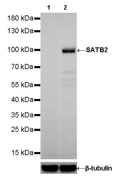 S-RMab® SATB2 Recombinant Rabbit mAb (SDT-R066)