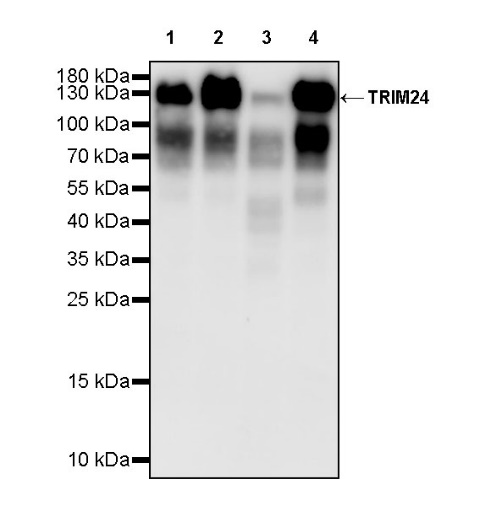 TRIM24 Recombinant Rabbit mAb (S-1029-77)