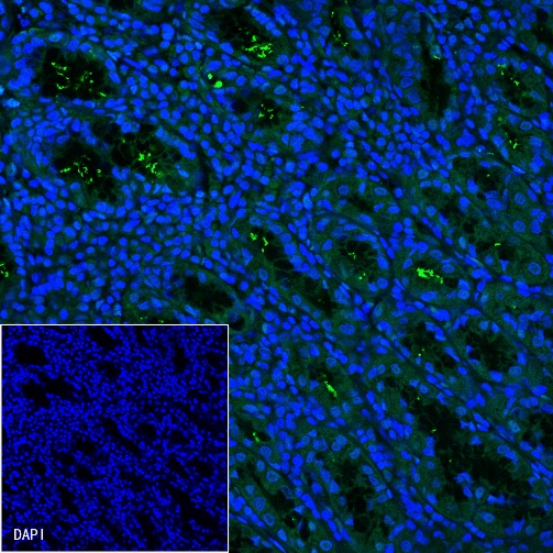 S-RMab® Helicobacter pylori Recombinant Rabbit mAb (FITC Conjugate) (S-R273)