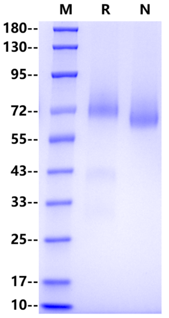 GPC3 His Tag Protein, Human