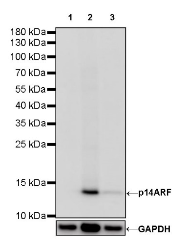 p14ARF Recombinant Rabbit mAb (S-R244)