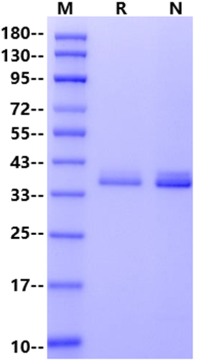 Apolipoprotein E/APOE4 His Tag, Human