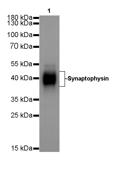 Synaptophysin Recombinant Rabbit  mAb (SDT-137-21)