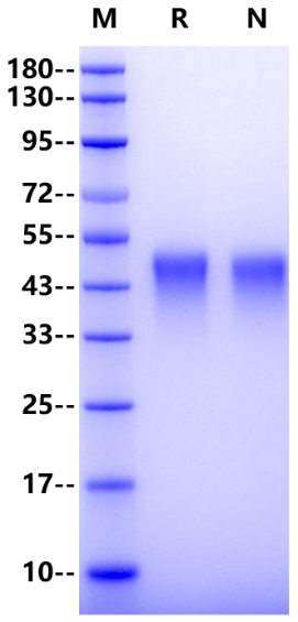 TIM-3/HAVCR2 His Tag Protein, Human