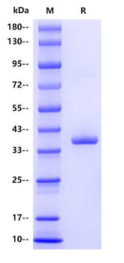 Human CCL3 Protein, hFc tag