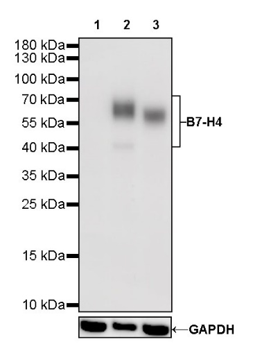 B7-H4 Recombinant Rabbit mAb (SDT-314-447)