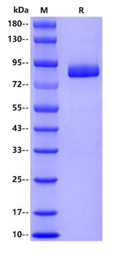 Human Lactotransferrin, His tag