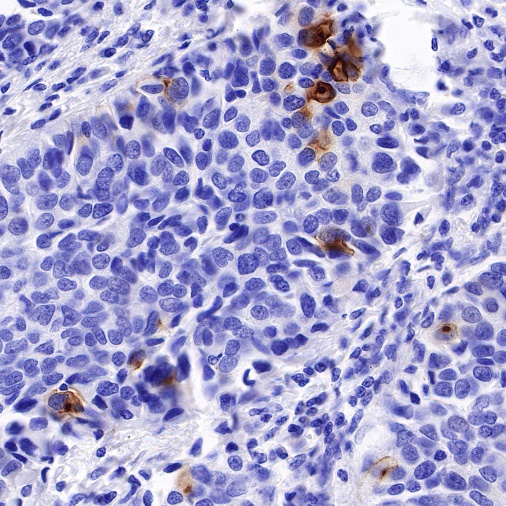 Uroplakin III Recombinant Rabbit mAb (SDT-R177)