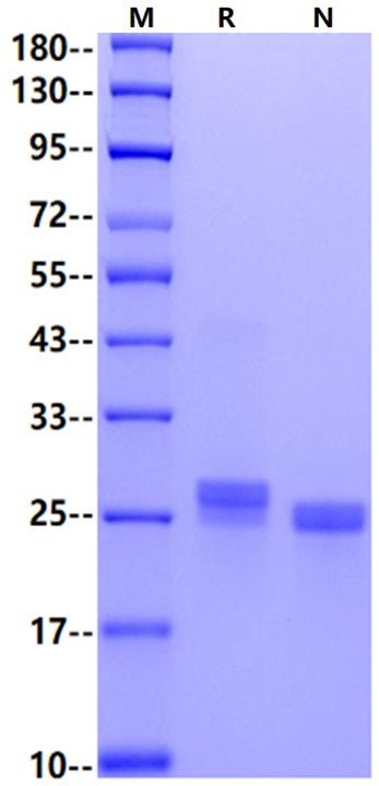 LCN2/NGAL His Tag Protein, Mouse