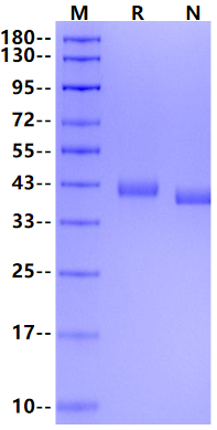Nectin-4 His Tag Protein, Cynomolgus