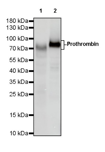Prothrombin Recombinant Rabbit mAb (S-R348)