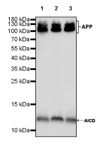 Amyloid Precursor Protein Recombinant Rabbit mAb (S-806-13)