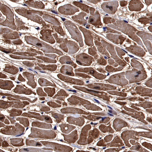 Cardiac Troponin I Recombinant Rabbit mAb (S-1352-28)