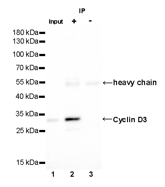 Cyclin D3 Recombinant Rabbit mAb (SDT-R124)